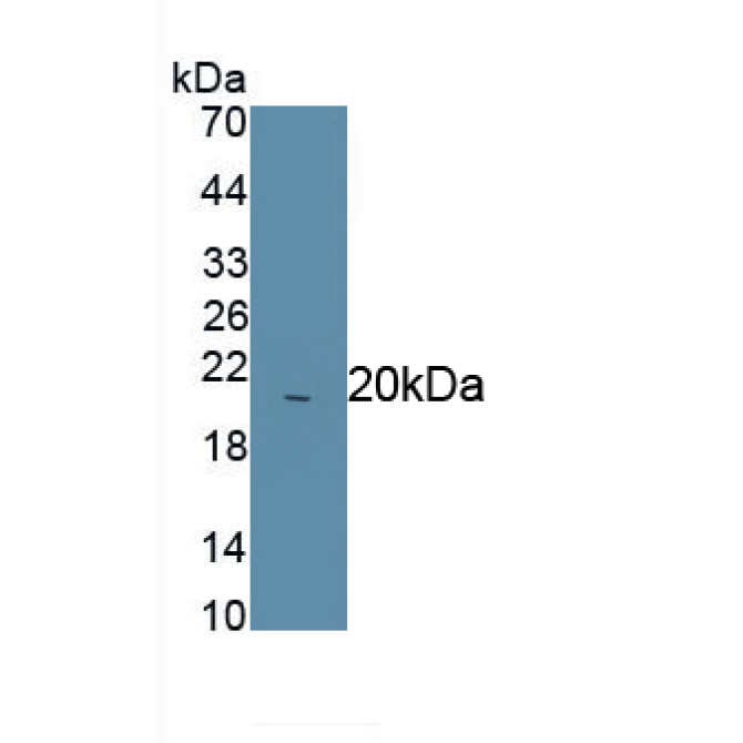 Asprosin Human Polyclonal Antibody