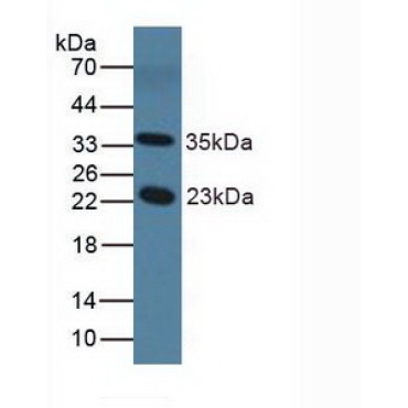 Nitric Oxide Synthase 1 Adaptor Protein (NOS1AP) Mouse Polyclonal Antibody