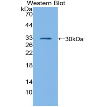 GATA Binding Protein 1 (GATA1) Mouse Polyclonal Antibody