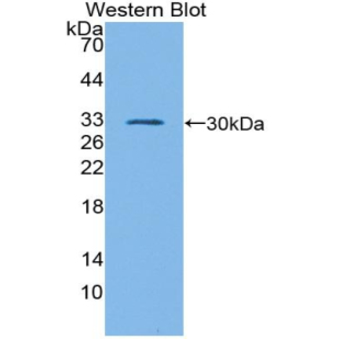 GATA Binding Protein 1 (GATA1) Mouse Polyclonal Antibody