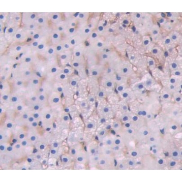 ATP Binding Cassette Transporter D1 (ABCD1) Human Polyclonal Antibody