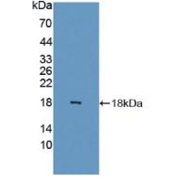 Fatty Acid Binding Protein 6, Ileal (FABP6) Human Polyclonal Antibody