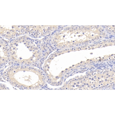 Cathepsin A (CTSA) Bovine (Cattle) Polyclonal Antibody