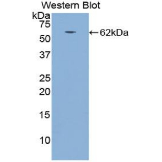 Cathepsin A (CTSA) Canis familiaris; Canine (Dog) Polyclonal Antibody