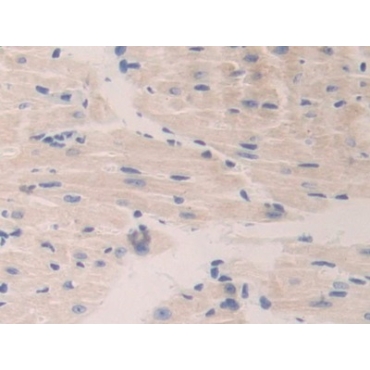 Cathepsin A (CTSA) Mouse Polyclonal Antibody