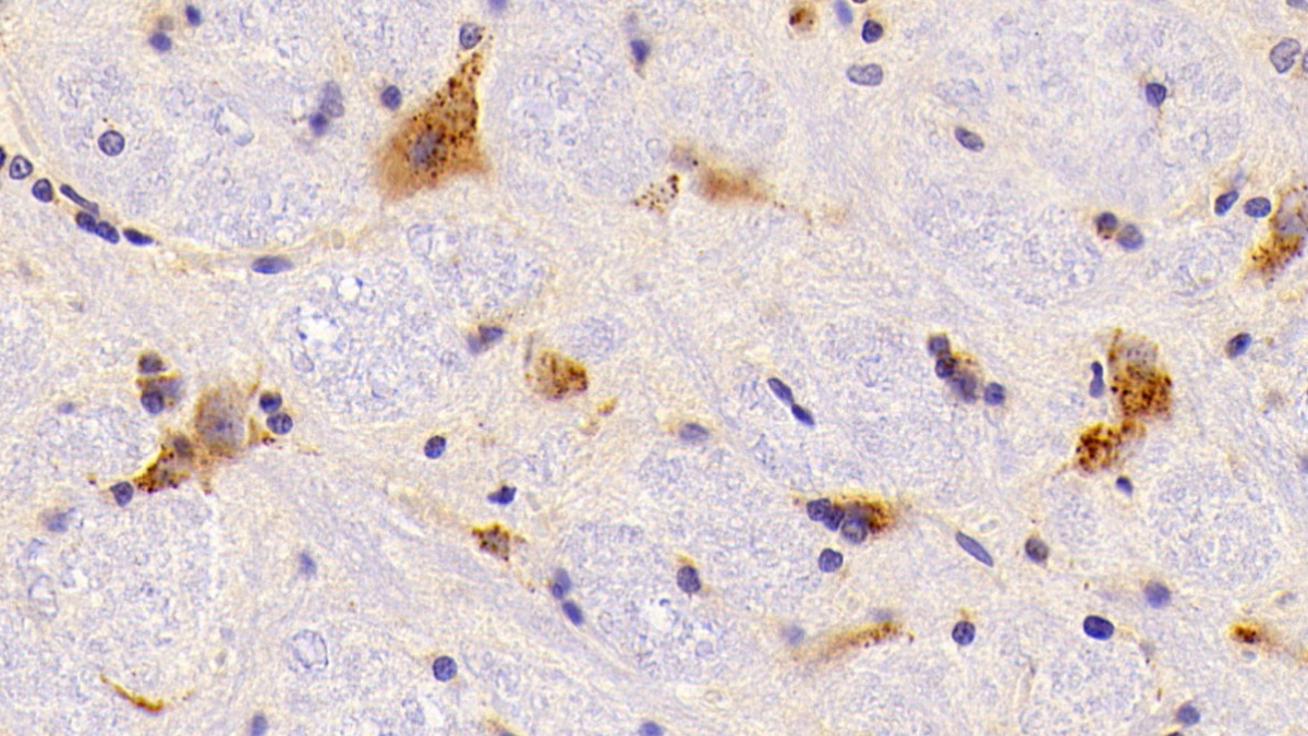 Cathepsin A (CTSA) Rat Polyclonal Antibody