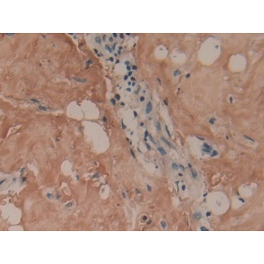 Collagen Type I Alpha 1 (COL1a1) Human Polyclonal Antibody