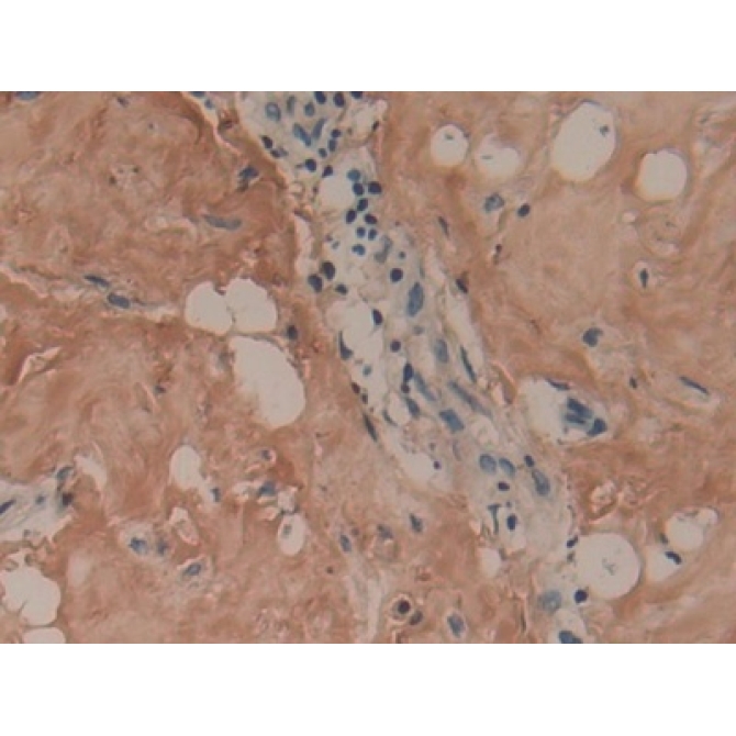 Collagen Type I Alpha 1 (COL1a1) Human Polyclonal Antibody
