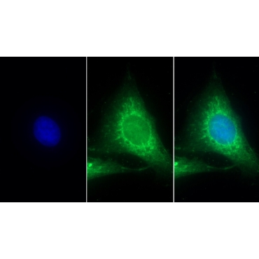 Collagen Type I Alpha 1 (COL1a1) Human Polyclonal Antibody