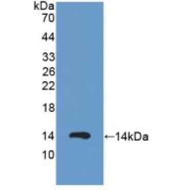 Protein Kinase Inhibitor Alpha (PKIa) Human Polyclonal Antibody