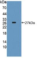Thyroglobulin (TG) Mouse Polyclonal Antibody