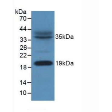 Acyl Carrier Protein, Mitochondrial (ACP) Human Polyclonal Antibody