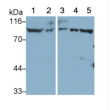 Platelet/Endothelial Cell Adhesion Molecule (PECAM1) Human Polyclonal Antibody