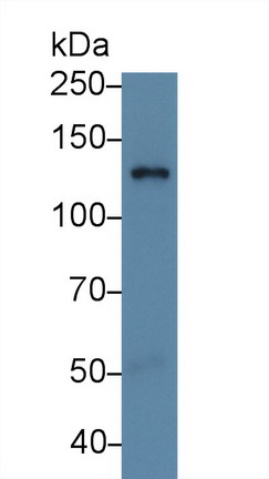 Retinol Binding Protein 3, Interstitial (RBP3) Human Polyclonal Antibody