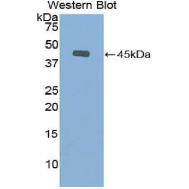 Gelsolin (GSN) Human Polyclonal Antibody