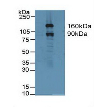 Gelsolin (GSN) Human Polyclonal Antibody