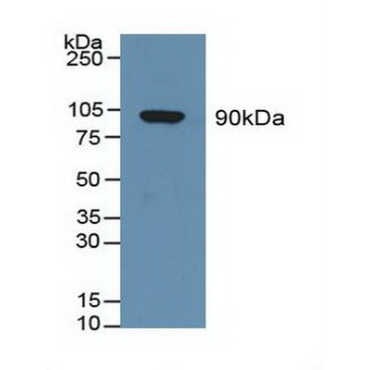 Gelsolin (GSN) Human Polyclonal Antibody