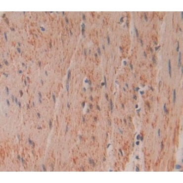 Gelsolin (GSN) Human Polyclonal Antibody