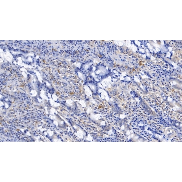Gelsolin (GSN) Human Polyclonal Antibody