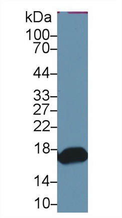 Retinol Binding Protein 2, Cellular (RBP2) Human Polyclonal Antibody