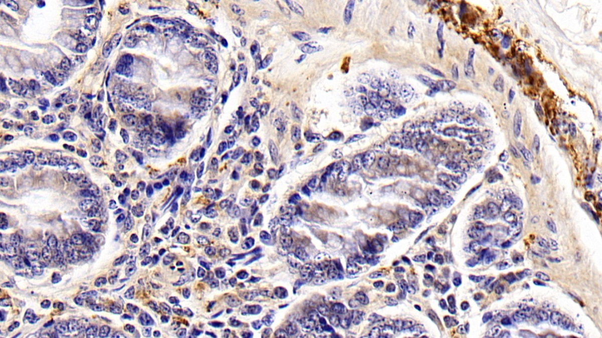 Vasoactive Intestinal Peptide (VIP) Bovine (Cattle) Polyclonal Antibody