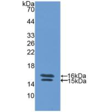 Vasoactive Intestinal Peptide (VIP) Human Polyclonal Antibody