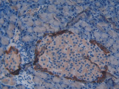 Vasoactive Intestinal Peptide (VIP) Rat Polyclonal Antibody