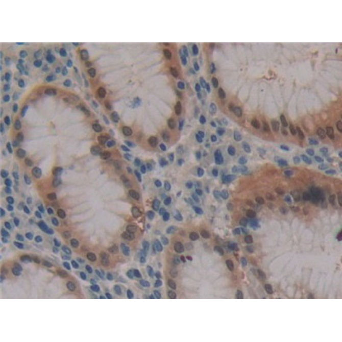 Fibrillin 3 (FBN3) Human Polyclonal Antibody
