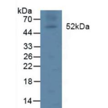 Lipoprotein lipase (LPL) Human Polyclonal Antibody