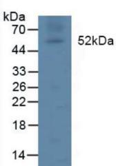 Lipoprotein lipase (LPL) Human Polyclonal Antibody
