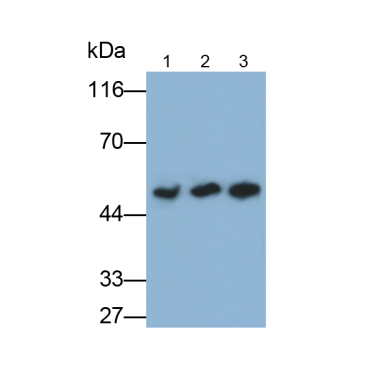 Lipoprotein lipase (LPL) Mouse Polyclonal Antibody