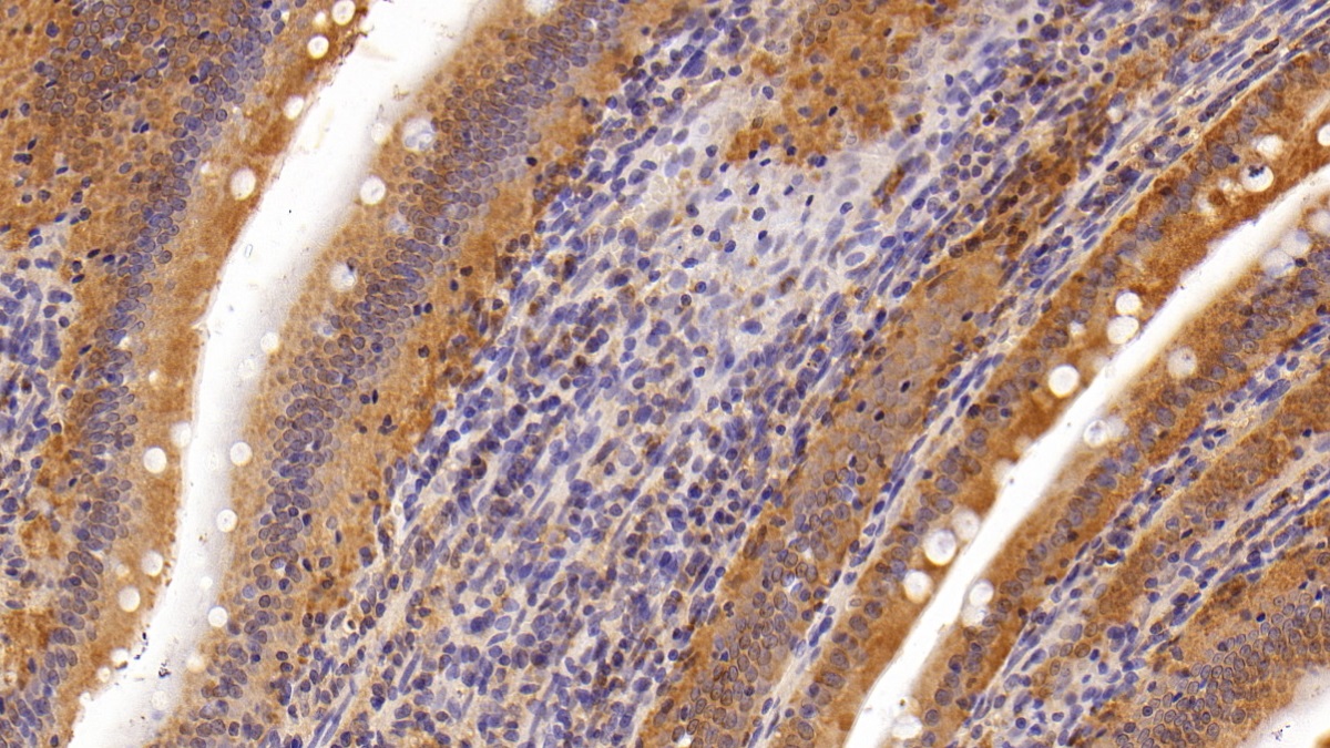 Lipoprotein lipase (LPL) Rat Polyclonal Antibody