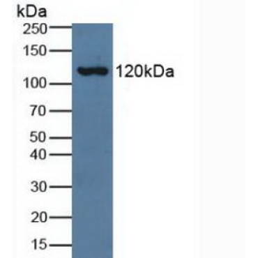 Complement Component 3a (C3a) Human Polyclonal Antibody