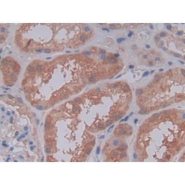 Complement Component 5a (C5a) Human Polyclonal Antibody