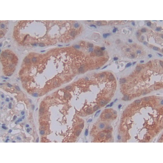 Complement Component 5a (C5a) Human Polyclonal Antibody
