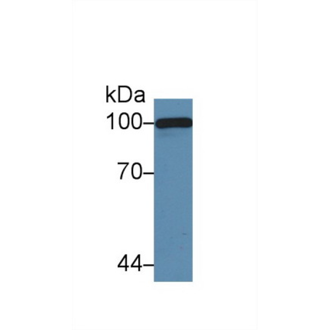 Complement Component 5a (C5a) Mouse Polyclonal Antibody