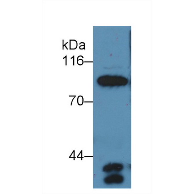 Complement Component 4a (C4a) Human Polyclonal Antibody