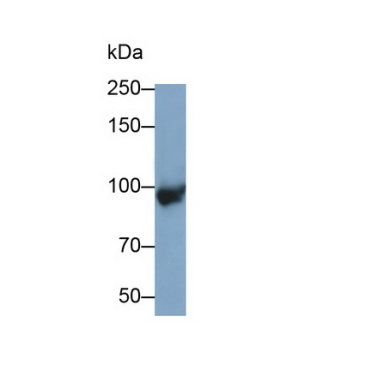 Complement Component 4a (C4a) Mouse Polyclonal Antibody