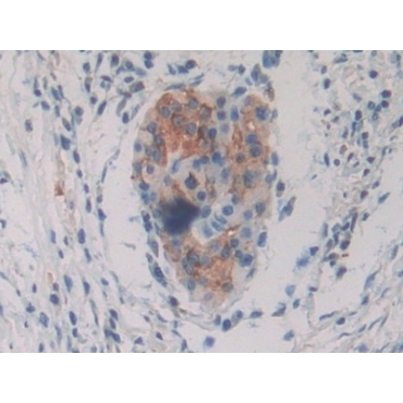 Protein Kinase Inhibitor Gamma (PKIg) Human Polyclonal Antibody