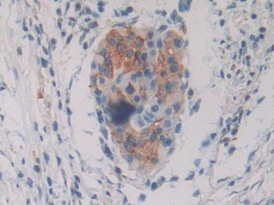 Protein Kinase Inhibitor Gamma (PKIg) Human Polyclonal Antibody