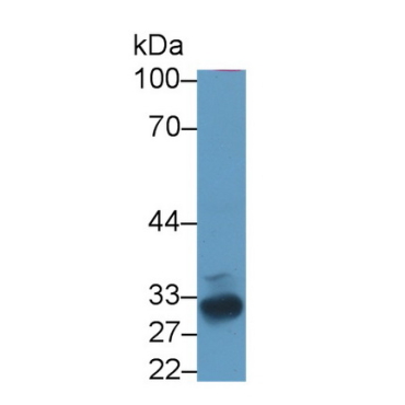 Follistatin (FS) Human Polyclonal Antibody
