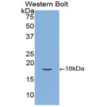 Tissue Factor Pathway Inhibitor (TFPI) Human Polyclonal Antibody