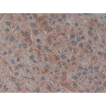 Tissue Factor Pathway Inhibitor (TFPI) Human Polyclonal Antibody