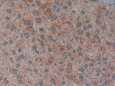 Tissue Factor Pathway Inhibitor (TFPI) Human Polyclonal Antibody