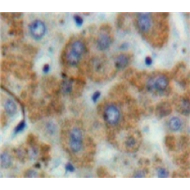 Tissue Factor Pathway Inhibitor (TFPI) Human Polyclonal Antibody