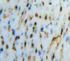 Tissue Factor Pathway Inhibitor (TFPI) Mouse Polyclonal Antibody