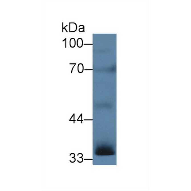Inhibin Alpha (INHa) Human Polyclonal Antibody