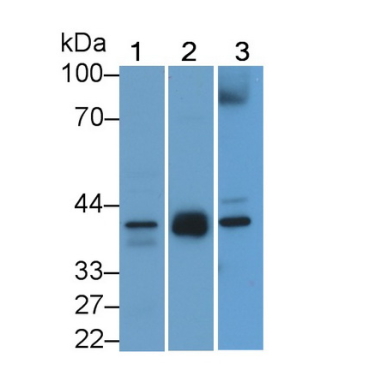 Inhibin Alpha (INHa) Human Polyclonal Antibody