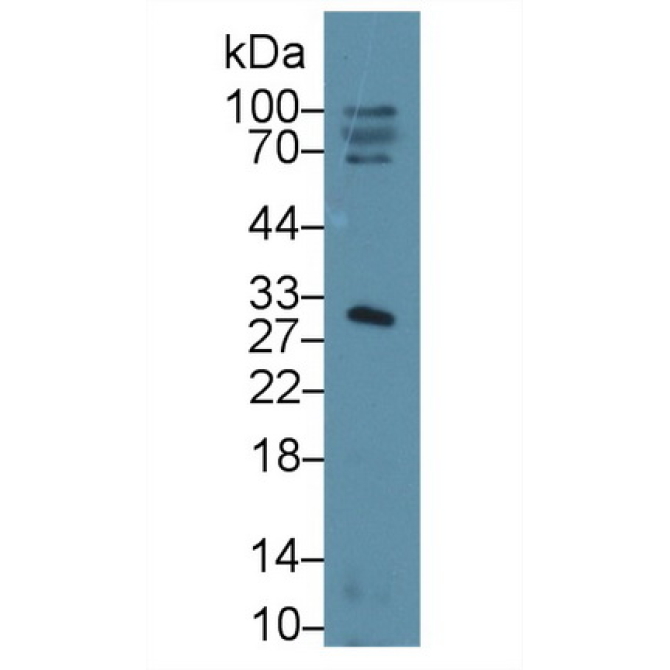 Sex Hormone Binding Globulin (SHBG) Human Polyclonal Antibody