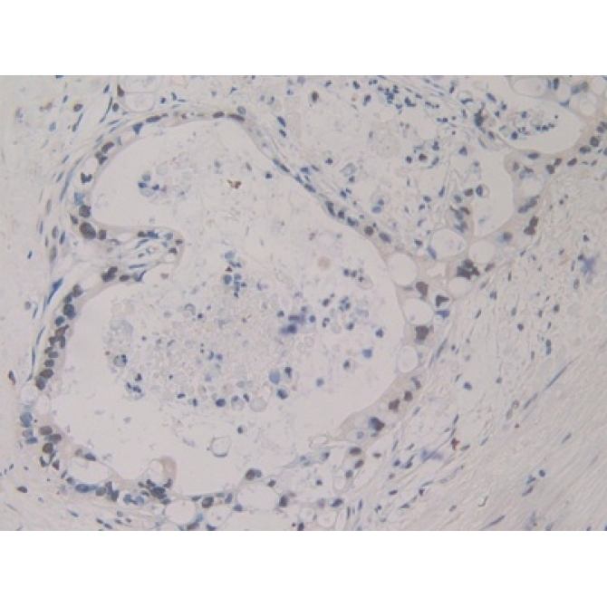 Sex Hormone Binding Globulin (SHBG) Human Polyclonal Antibody